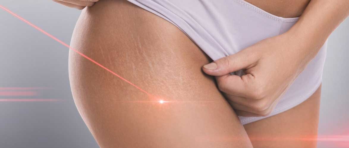 Image of TheraLight